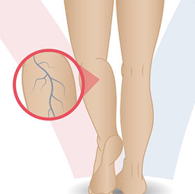 daniel-duarte-cirurgia-vascular-exames-ecodoppler-thumb